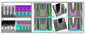 Fig. 4. Model calibration based on TEM cross sections for (a) fin self-aligned double patterning, (b) source/drain epitaxial growth and contacts, and (c) gate-to-source/drains spacers.